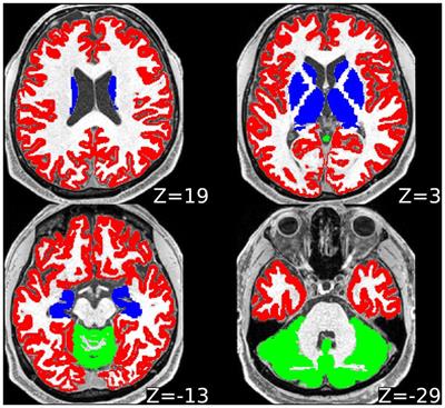 Utility of quantitative MRI metrics in brain ageing research